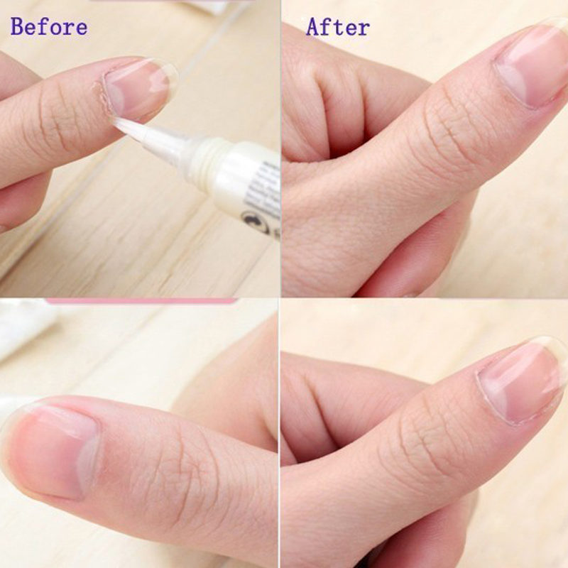 1pcs Cuticle Oil Pen Nail Nutr - Cuticle Oil Pen 评论和价格