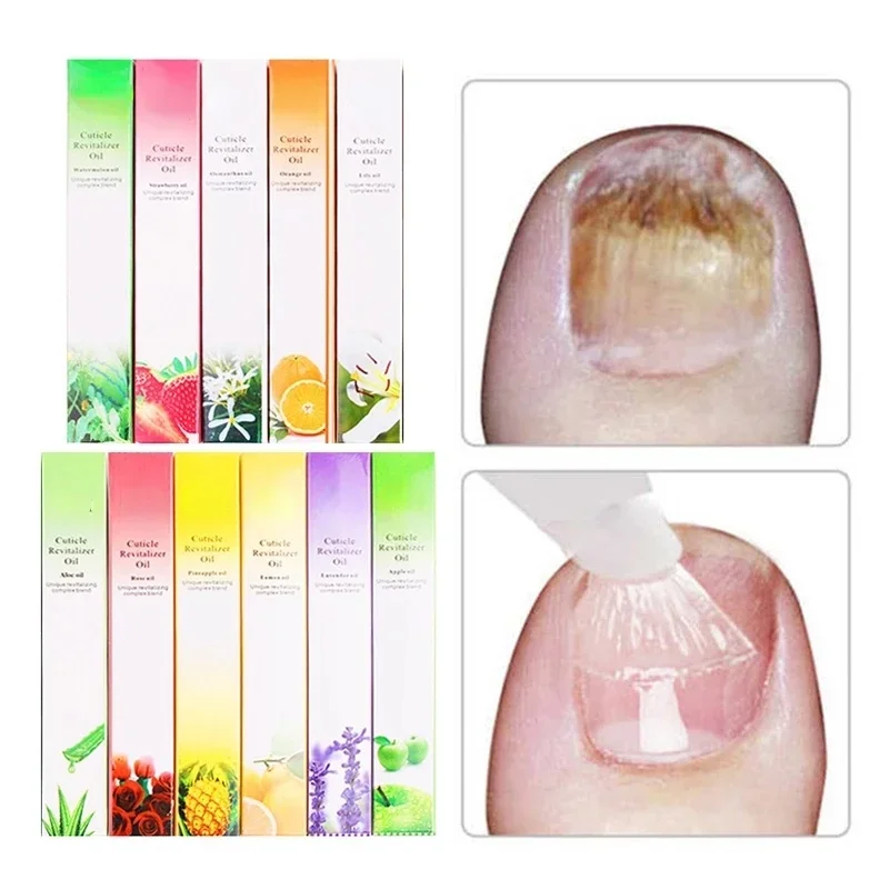 6PCS Cuticle Oil Pen Nail Nutr - Cuticle Oil Pen 评论和价格